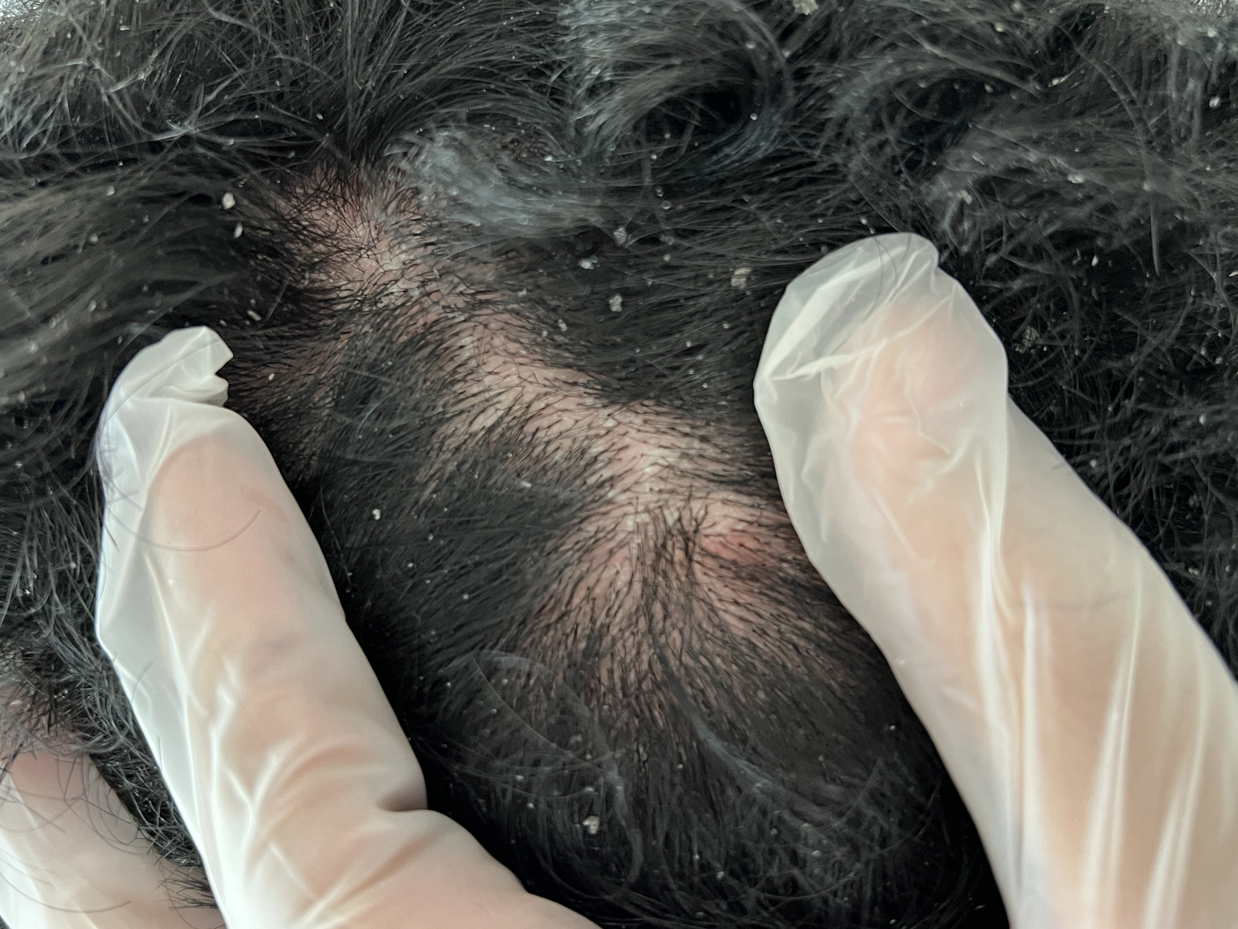Dermatitis antes