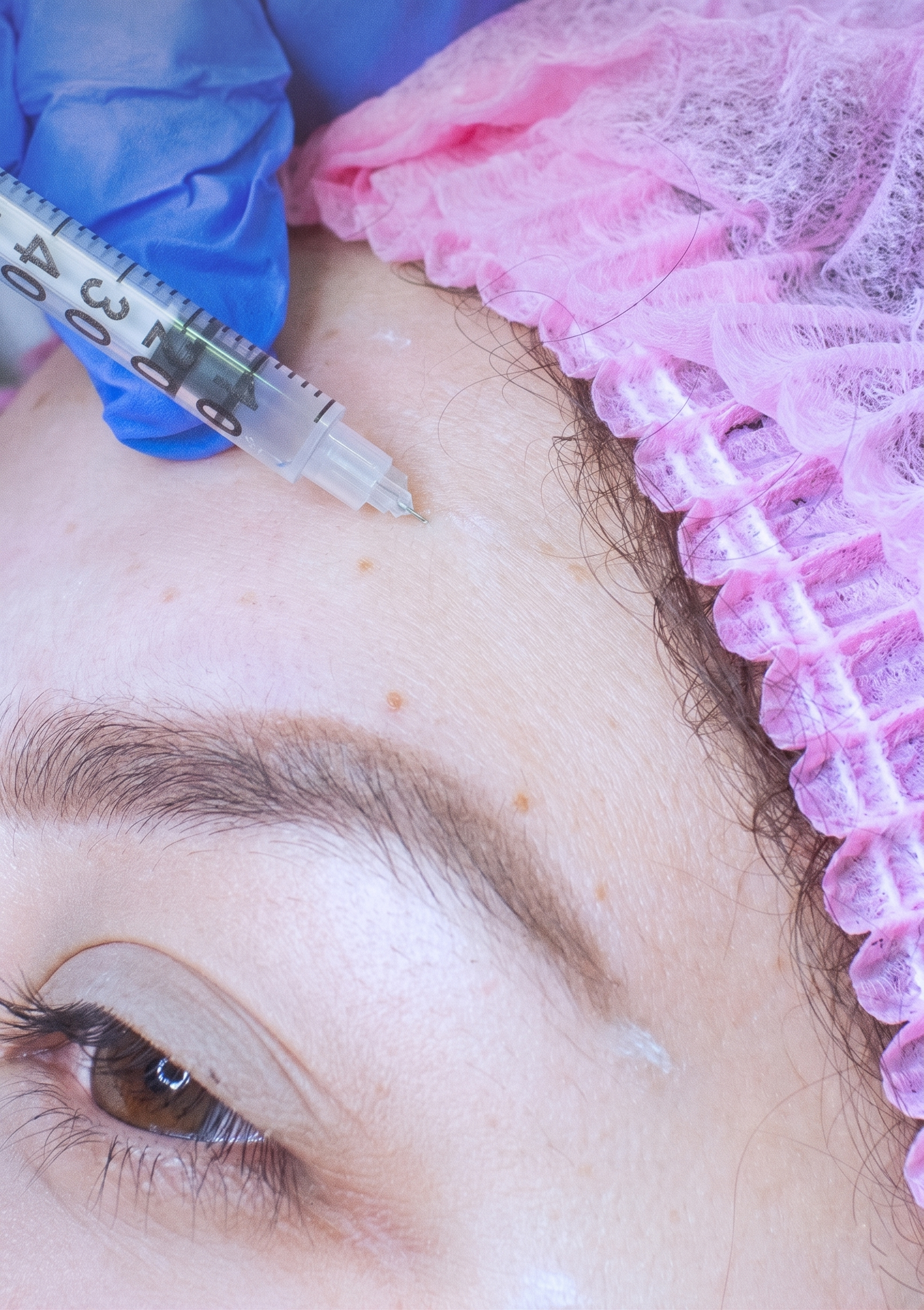 Botox